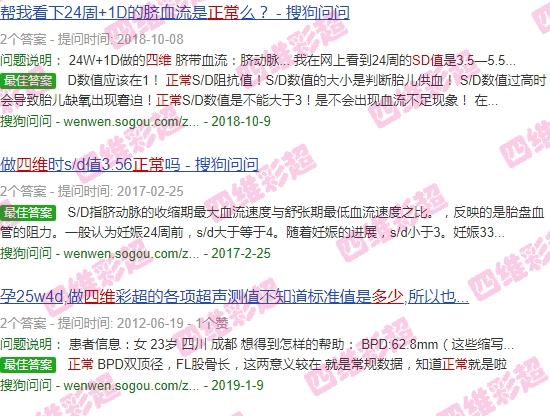 做四維sd值多少正常 - 汕頭四維sd值多少正常