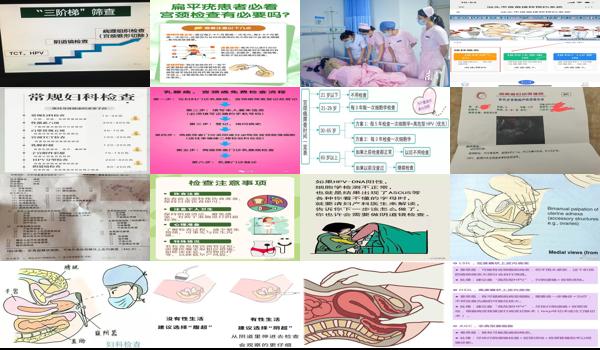 汕頭市hpv檢查 - 汕頭檢查宮頸怎么查