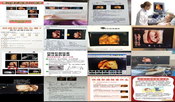 懷孕六個(gè)月做四維彩超要多少錢 - 汕頭孕六個(gè)月時(shí)需要做個(gè)四維彩超產(chǎn)前排畸
